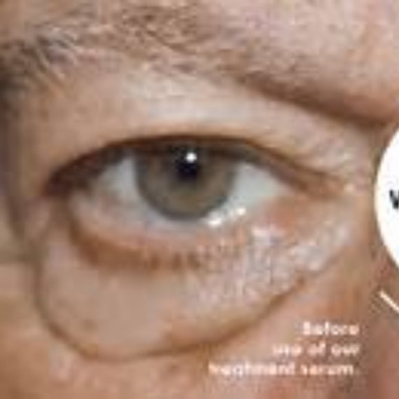 New 2 Professional Hollywood Eye Magic Under Eye Serum Treatment 15 ml & 4 ml - Picture 8 of 10